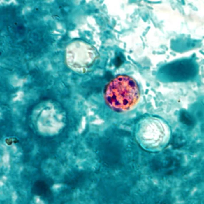 What to know about diarrhea-causing foodborne parasite cyclospora
